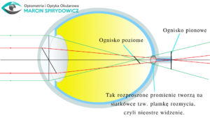 Oko-astygmatyzm-optometria