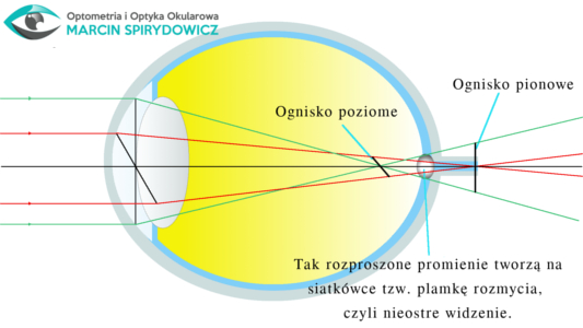 Astygmatyzm okiem optometrysty