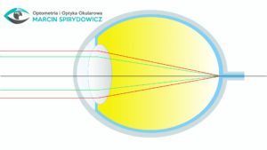 Optometria-oko-bez-astygmatyzmu